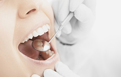 一般歯科・歯周病治療・短期集中治療