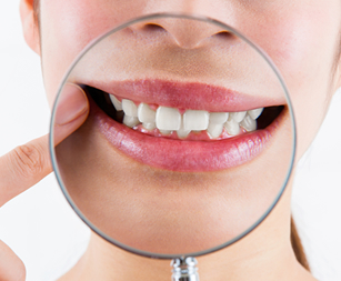 虫歯予防の習慣をつける