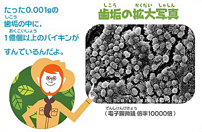 プラークが引き起こす病気について | 名張市の歯医者「かめい歯科クリニック」スタッフブログ
