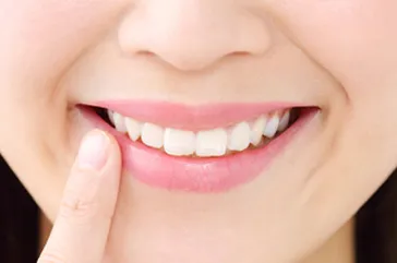 矯正歯科とは、健康できれいな歯並び、新しい自分への第一歩！